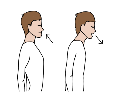 pectus