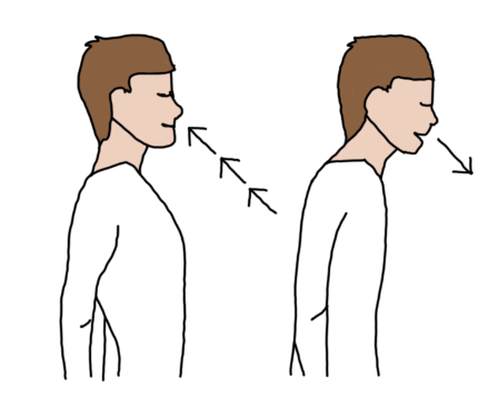 pectus