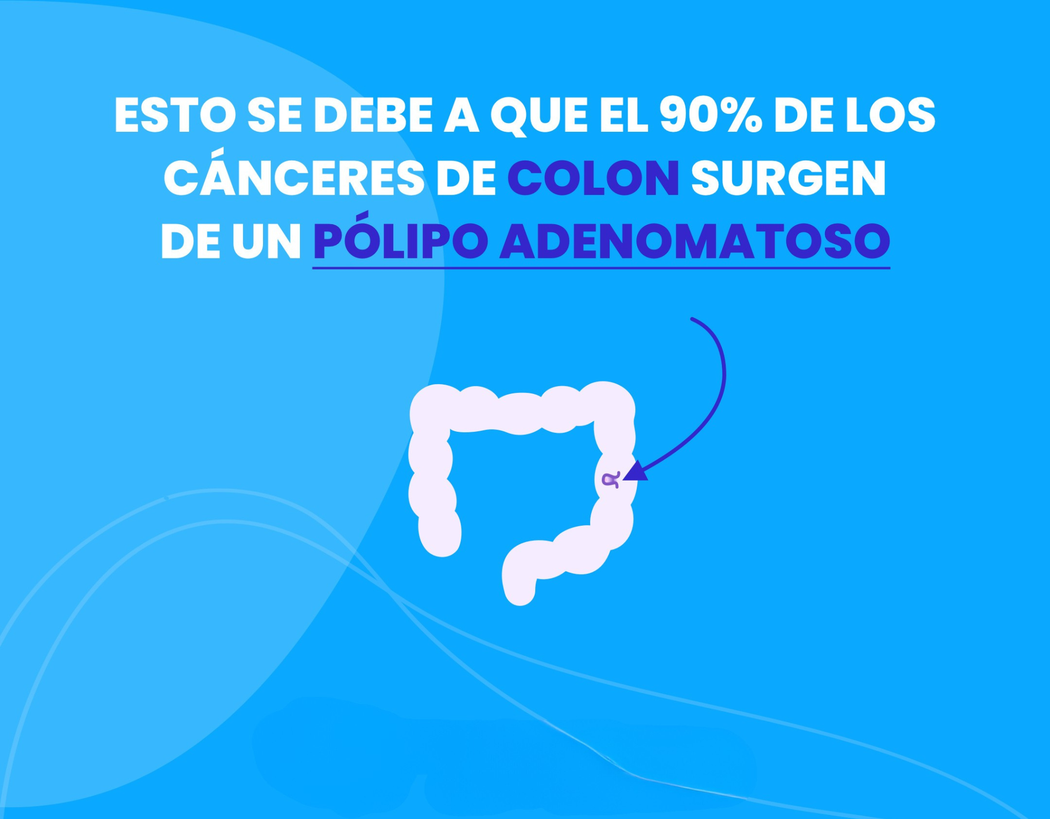 Placa 2