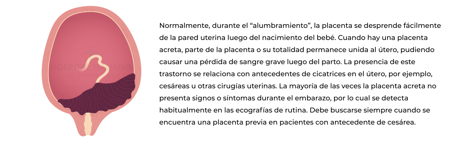 Acretismo placentario-Programa obstetricia
