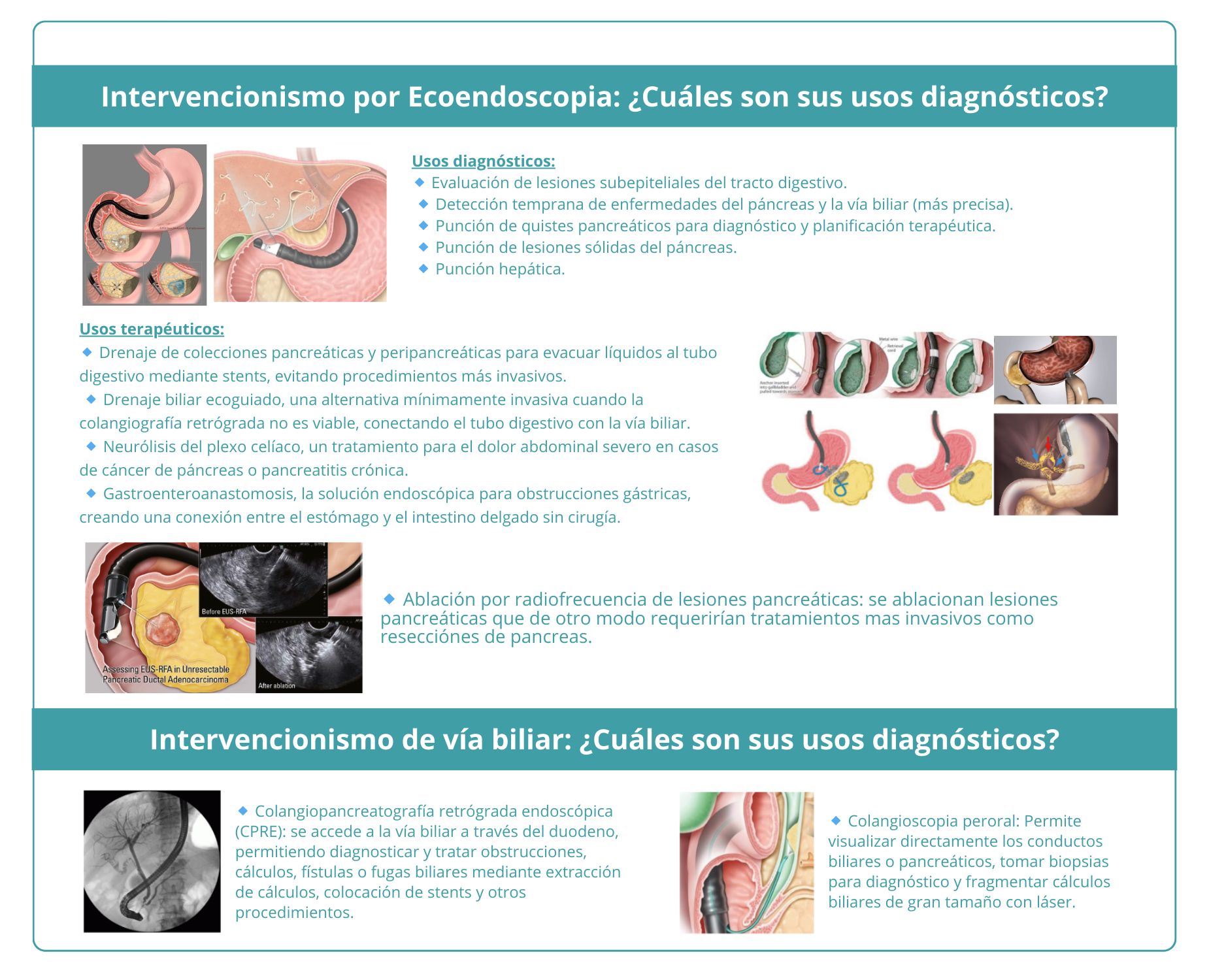 Intervencionismo-Gastroenterología