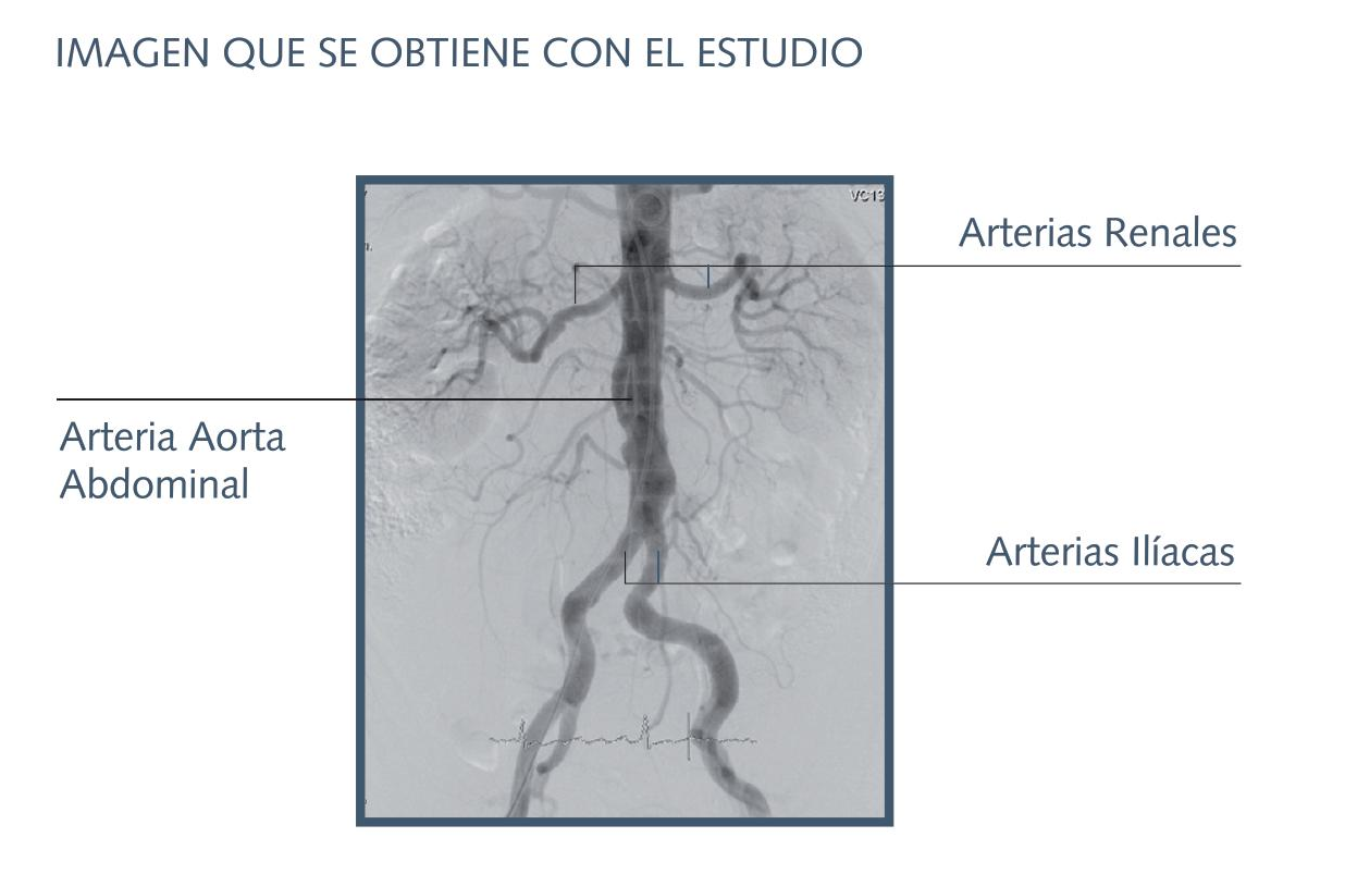 hemodinamia