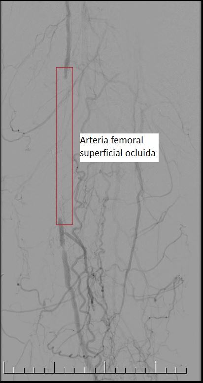 arterio1