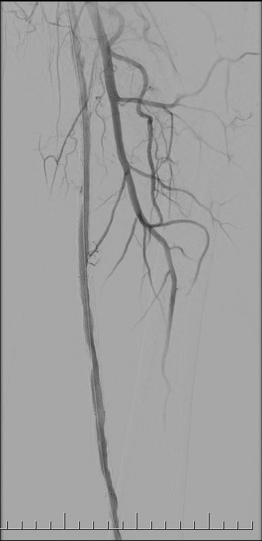 arterio2