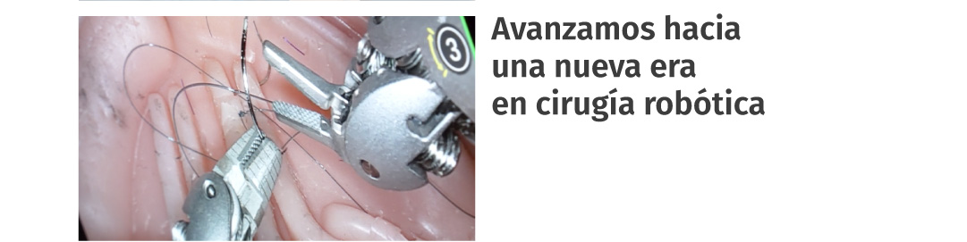Avanzamos hacia una nueva era en cirugía robótica