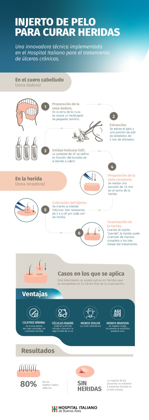injertos