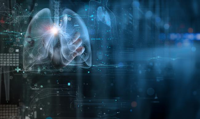 Innovacion en el diagnostico - neumonologia - CTA