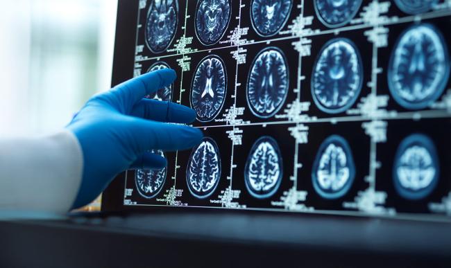 2. Investigación e innovación - Neurología Pediátrica - CTA.jpg