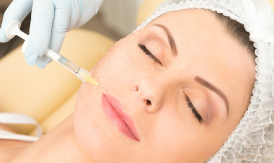 Mesoterapia