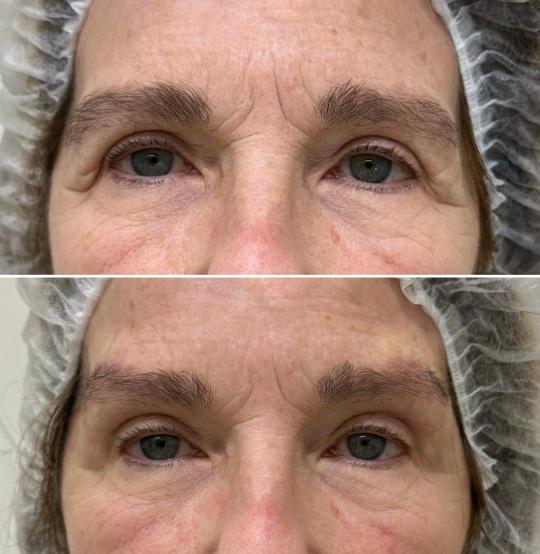 Dermatología