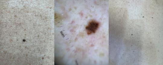 Dermatología