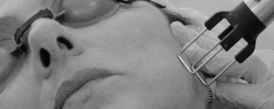 Coolpeel